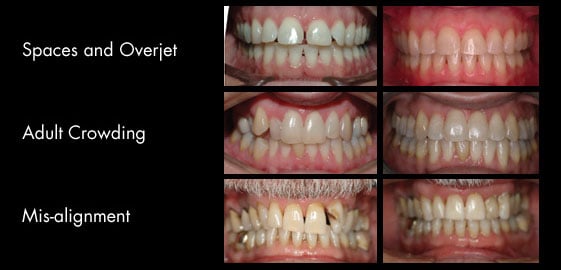 before after images JUN08 2010 2