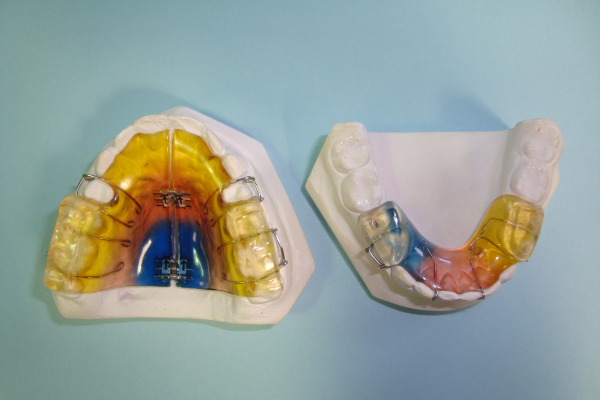 Upper Palatal Expander Lower Twin Block