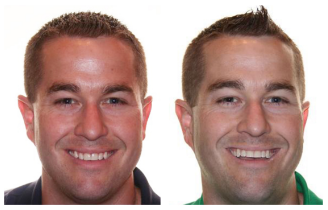 before after1