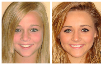 before after3
