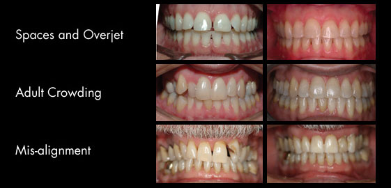 Before and After Gallery