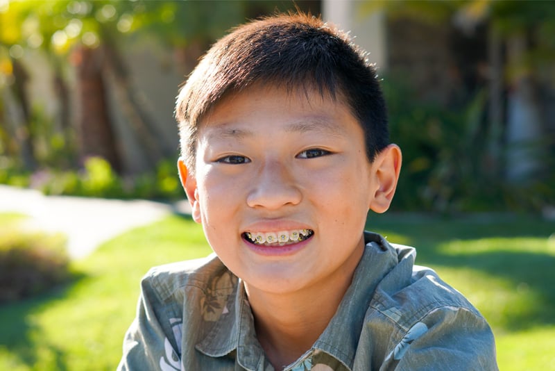 Pinole Orthodontist 31 young boy braces 800